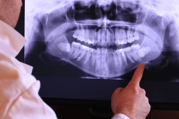 Best Walk-In Emergency Dental Services in Addis, LA