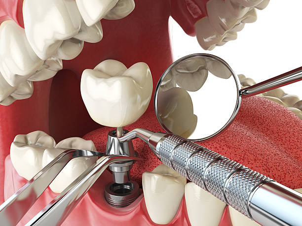 Trusted LA Emergency Dental Service Experts